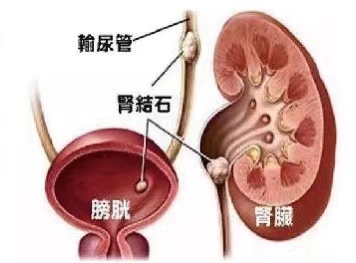 微信图片_20201123161311.jpg