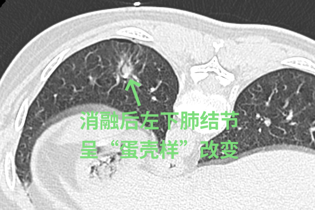 微信图片_20240419155649.png