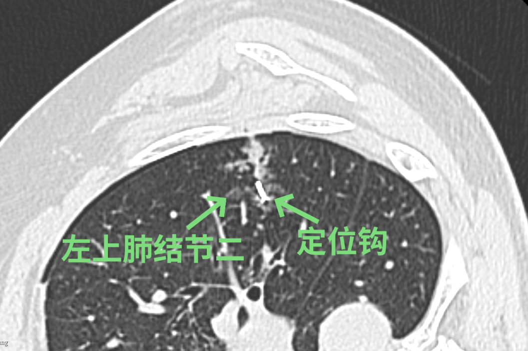 微信图片_20240419155645.png